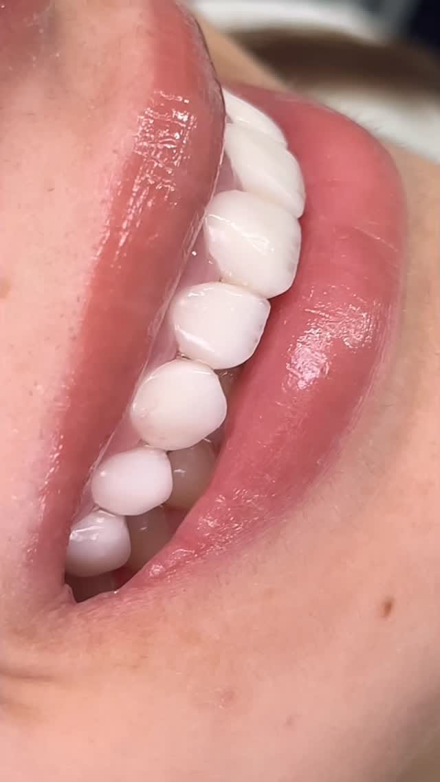 Post 4 by Dr.ALhareth Abu Mufereh on Instagram (video)