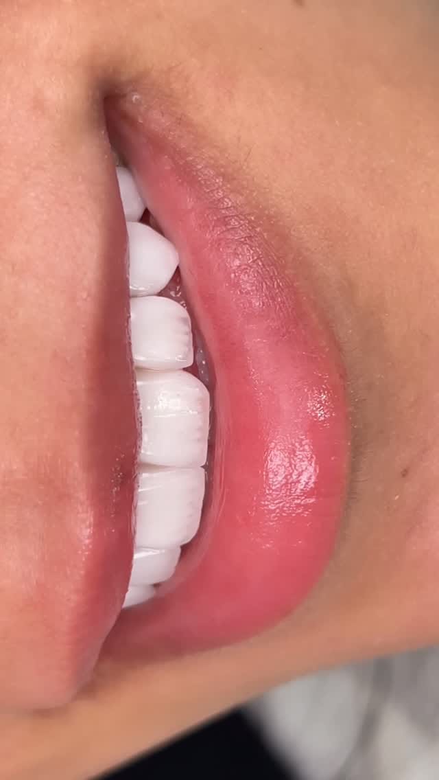 Post 9 by Dr.ALhareth Abu Mufereh on Instagram (video)