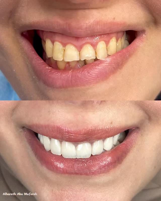 Post 8 by Dr.ALhareth Abu Mufereh on Instagram (video)