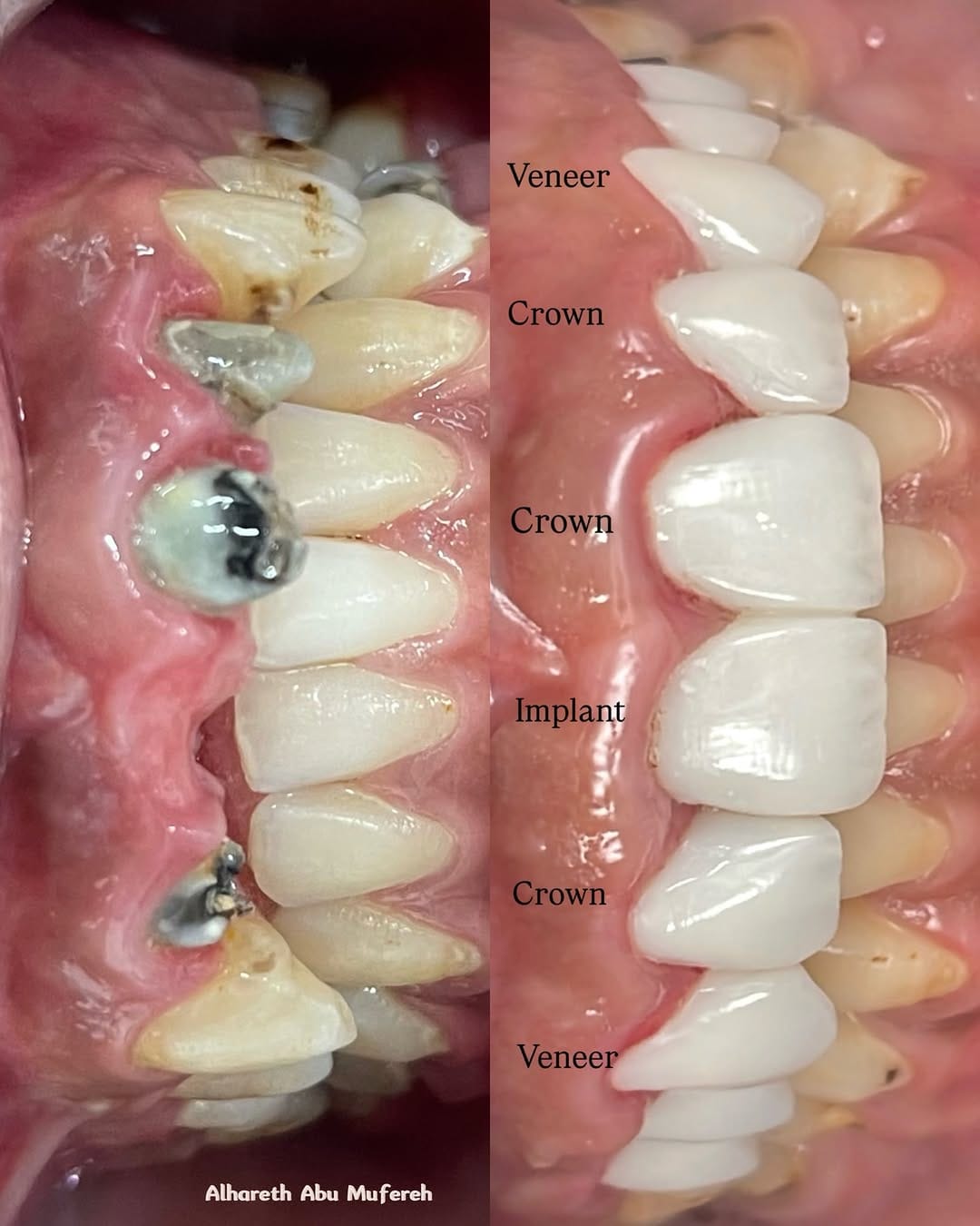 Post 10 by Dr.ALhareth Abu Mufereh on Instagram (image)
