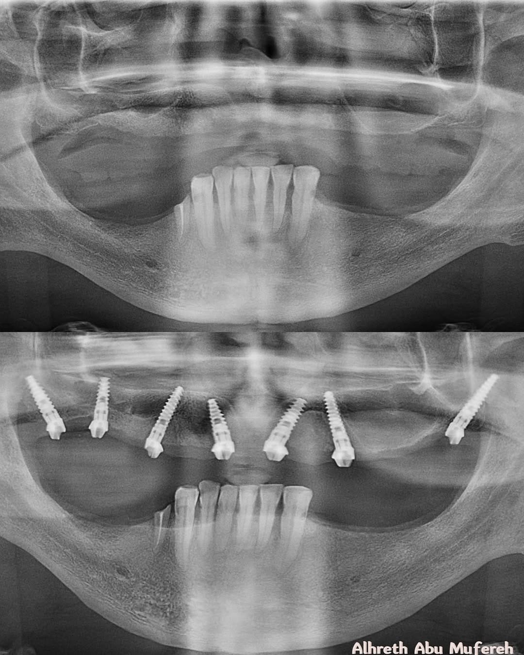 Post 5 by Dr.ALhareth Abu Mufereh on Instagram (image)