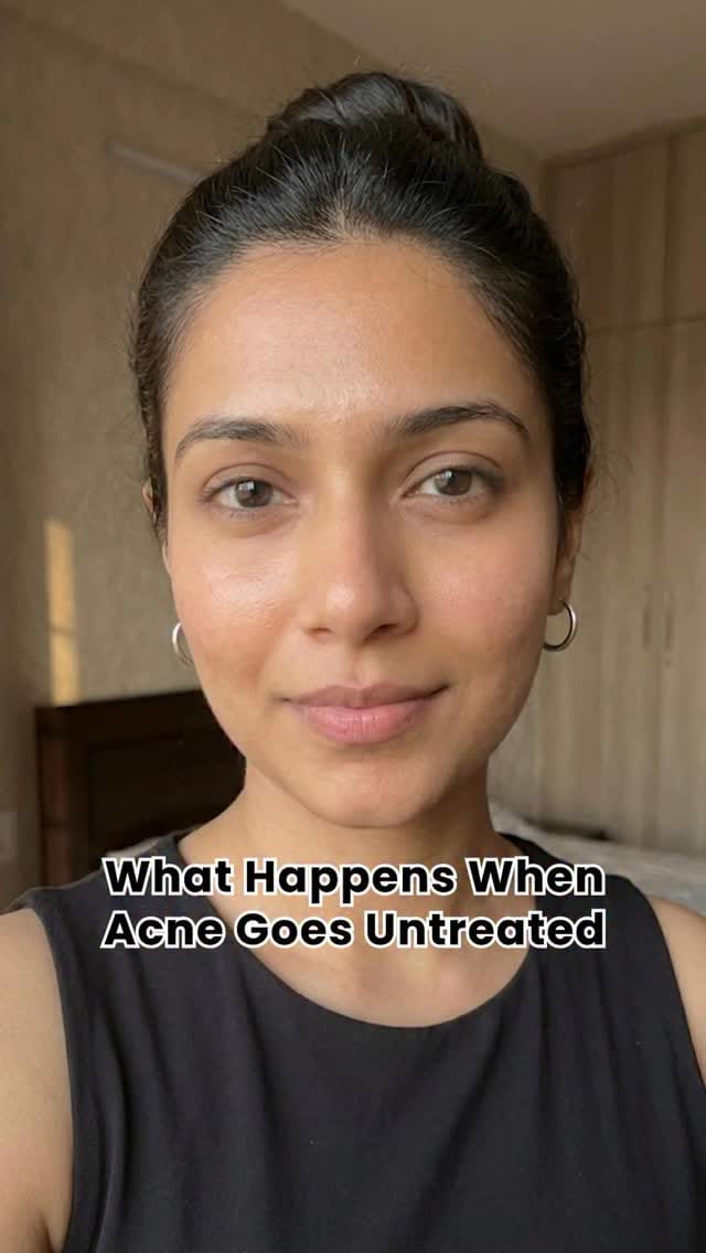 Post 2 by Dr. Reena Sharma | Dermatologist | Noida on Instagram (video)