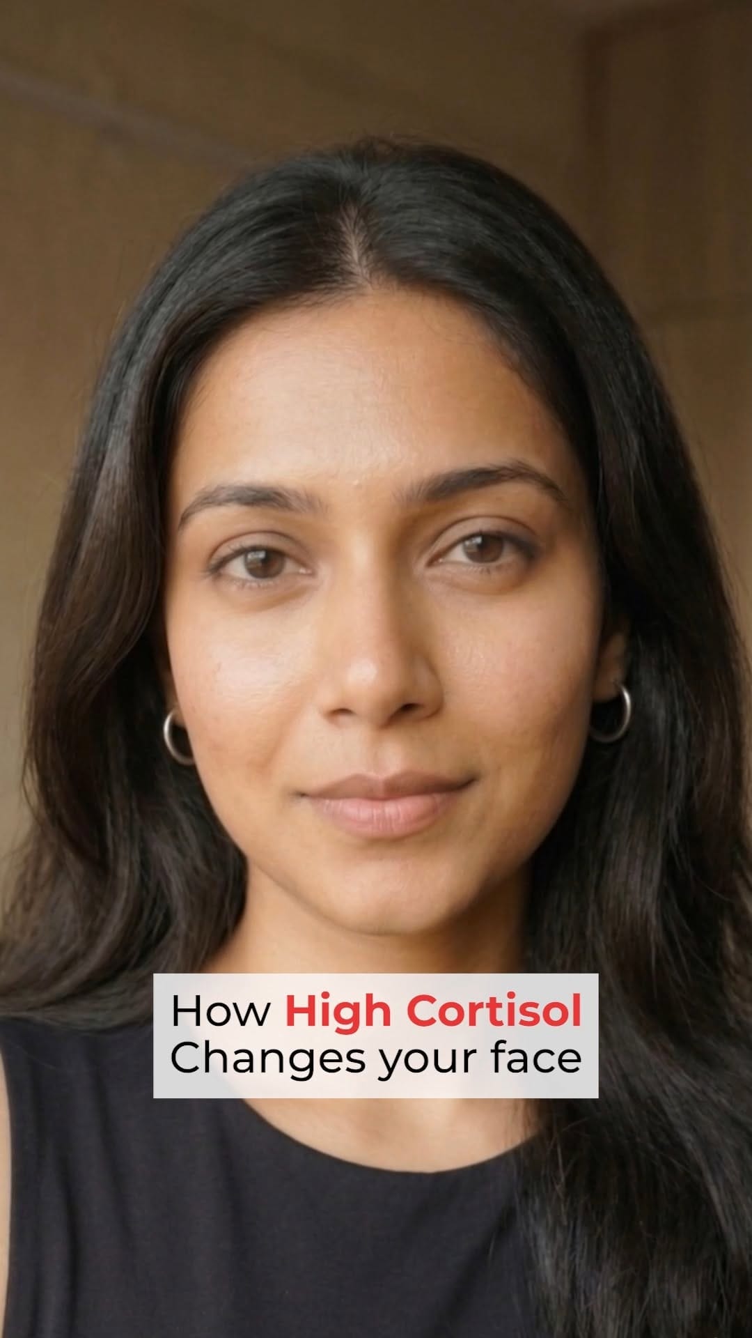Post 10 by Dr. Reena Sharma | Dermatologist | Noida on Instagram (video)