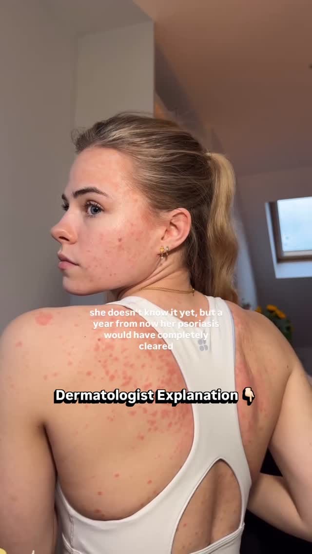 Post 5 by Dr. Reena Sharma | Dermatologist | Noida on Instagram (video)
