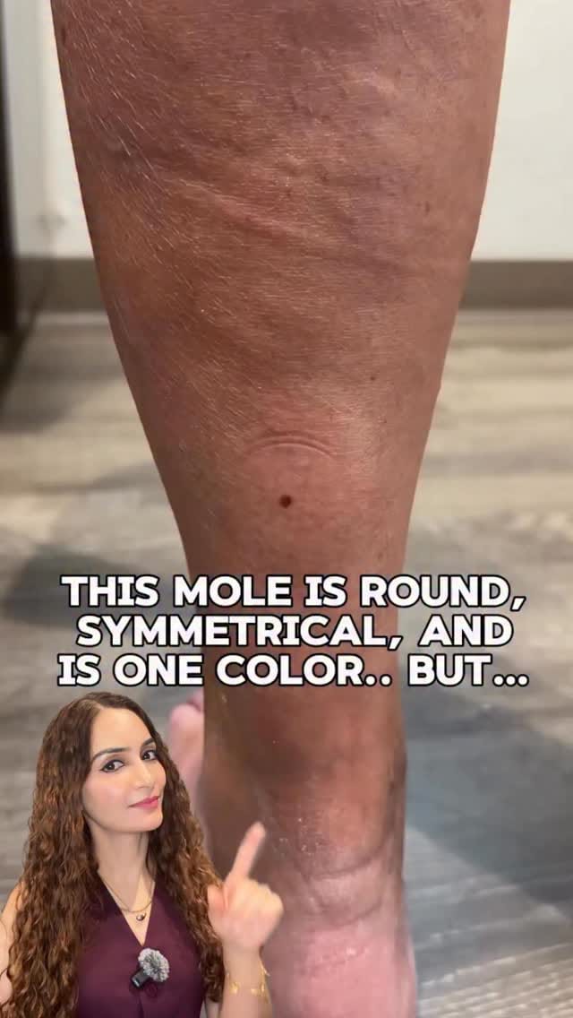 Post 4 by Dr. Reena Sharma | Dermatologist | Noida on Instagram (video)