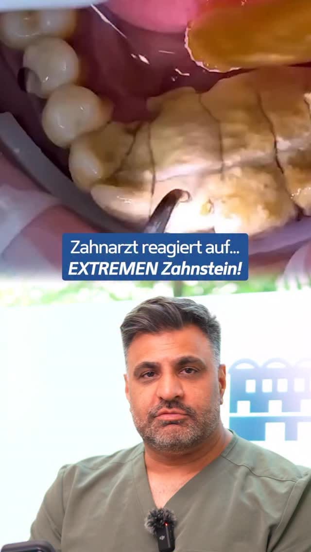 Post 6 by Adjmal Sheerzoi DDS MSc | Zahnarzt Düsseldorf on Instagram (video)