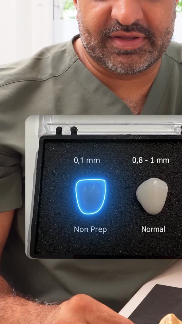 Post 10 by Adjmal Sheerzoi DDS MSc | Zahnarzt Düsseldorf on Instagram (video)