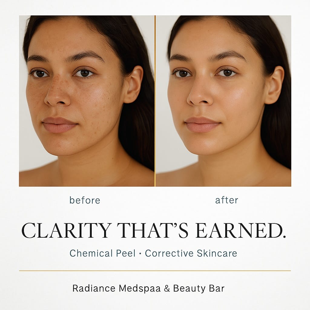 Post 7 by Radiance Medspa & Beauty Bar |  Voted Top Choice Medical Spa 🏆 on Instagram (image)