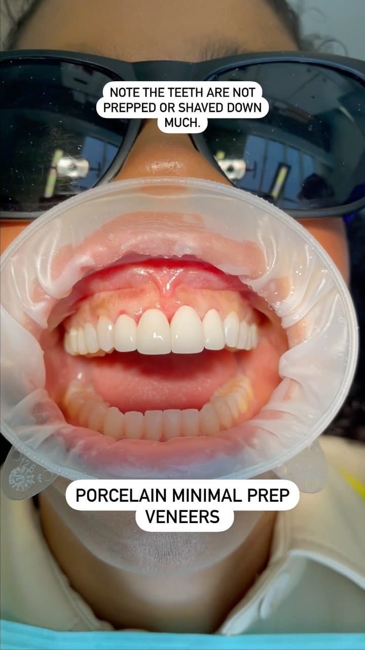 Post 10 by Dr. Neda Rafati  | Dentist Coach on Instagram (video)