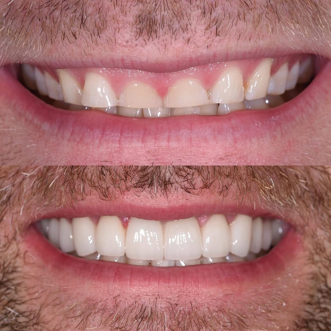 Post 9 by Dr. Neda Rafati  | Dentist Coach on Instagram (carousel)