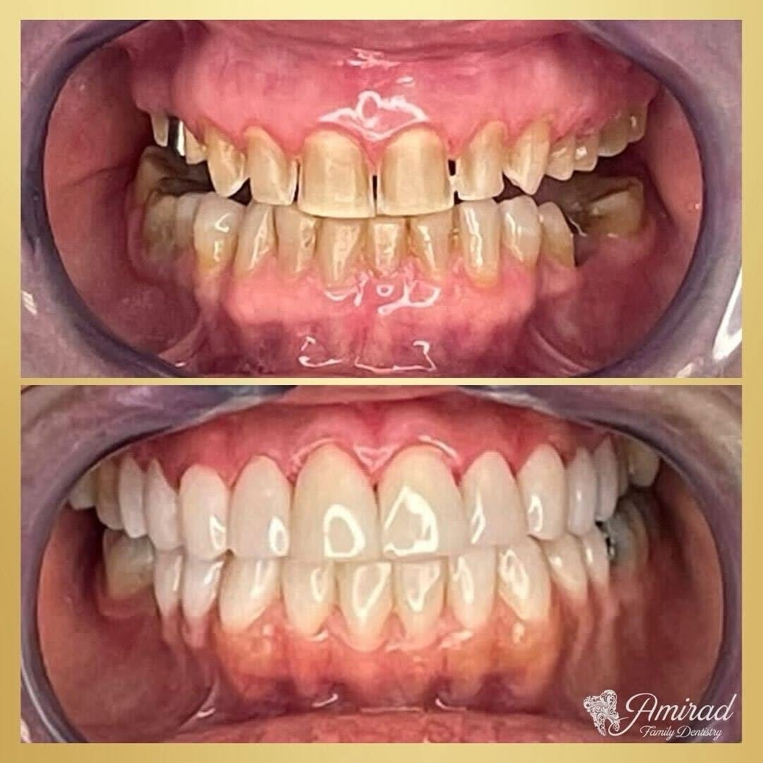Post 7 by Amirad Family Dentistry on Instagram (image)