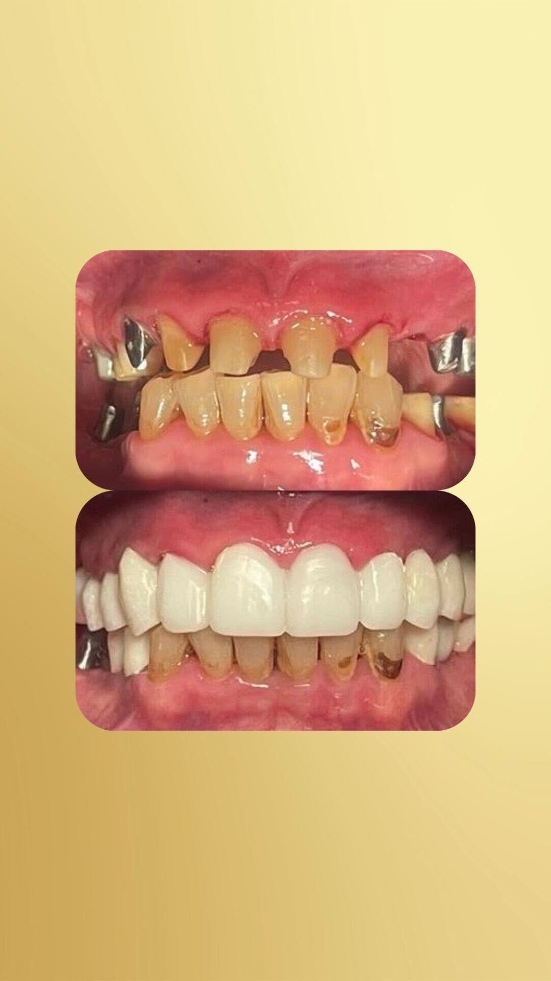 Post 2 by Amirad Family Dentistry on Instagram (video)