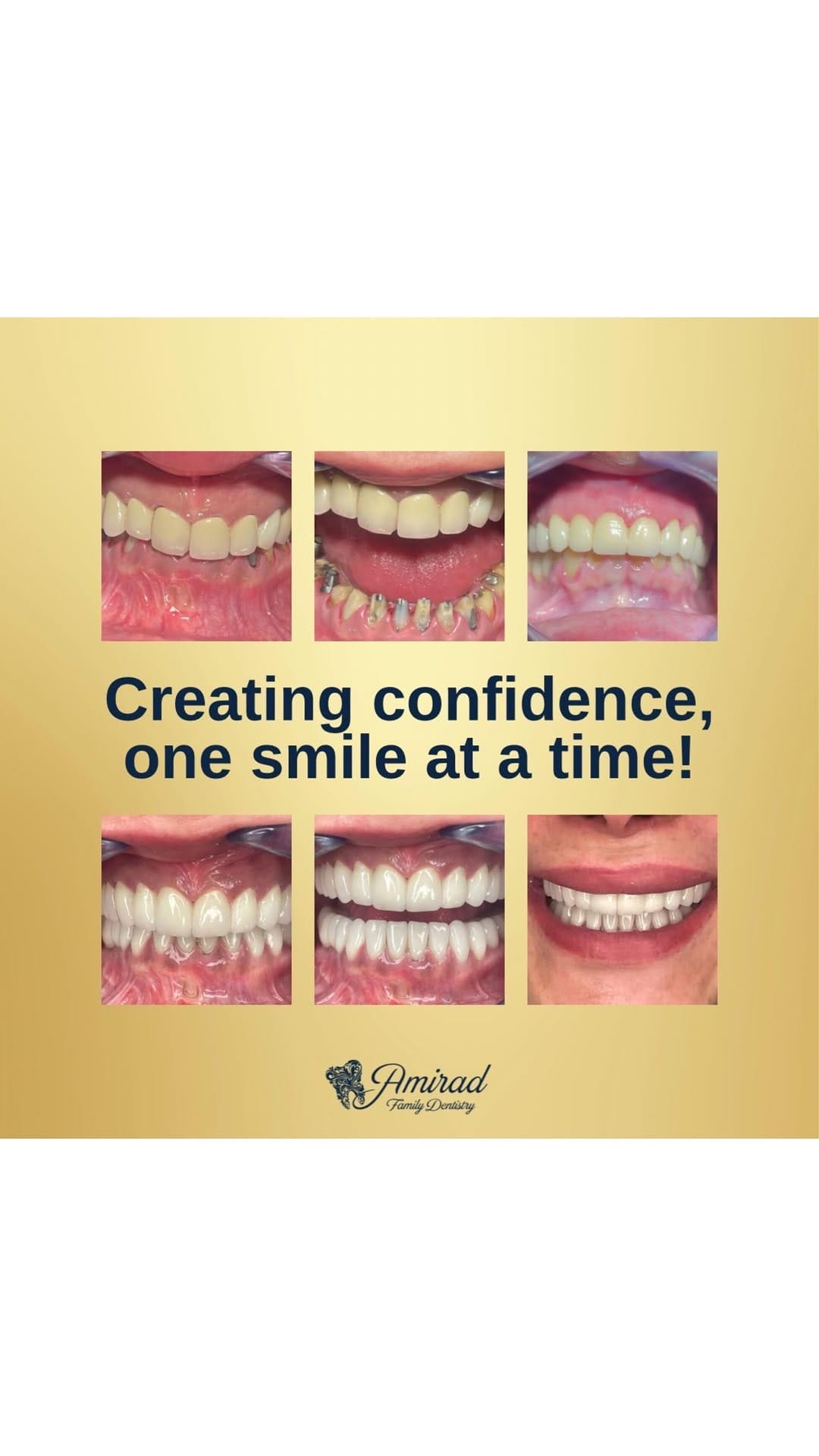 Post 4 by Amirad Family Dentistry on Instagram (video)