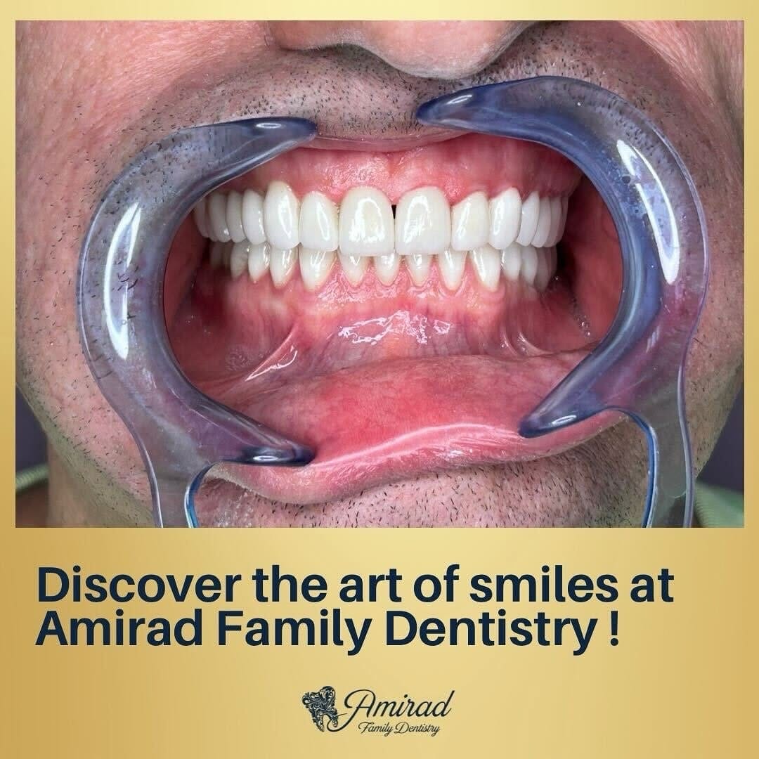 Post 5 by Amirad Family Dentistry on Instagram (image)