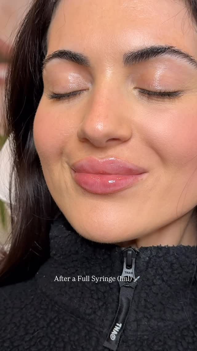 Post 7 by 𝐓𝐎𝐑𝐎𝐍𝐓𝐎 𝐂𝐎𝐒𝐌𝐄𝐓𝐈𝐂 𝐍𝐔𝐑𝐒𝐄💉 on Instagram (video)