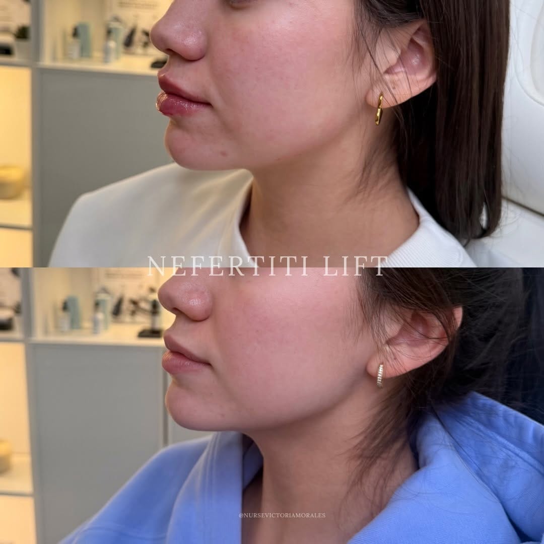 Post 5 by 𝐓𝐎𝐑𝐎𝐍𝐓𝐎 𝐂𝐎𝐒𝐌𝐄𝐓𝐈𝐂 𝐍𝐔𝐑𝐒𝐄💉 on Instagram (carousel)