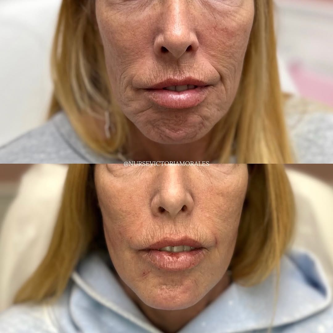 Post 9 by 𝐓𝐎𝐑𝐎𝐍𝐓𝐎 𝐂𝐎𝐒𝐌𝐄𝐓𝐈𝐂 𝐍𝐔𝐑𝐒𝐄💉 on Instagram (image)