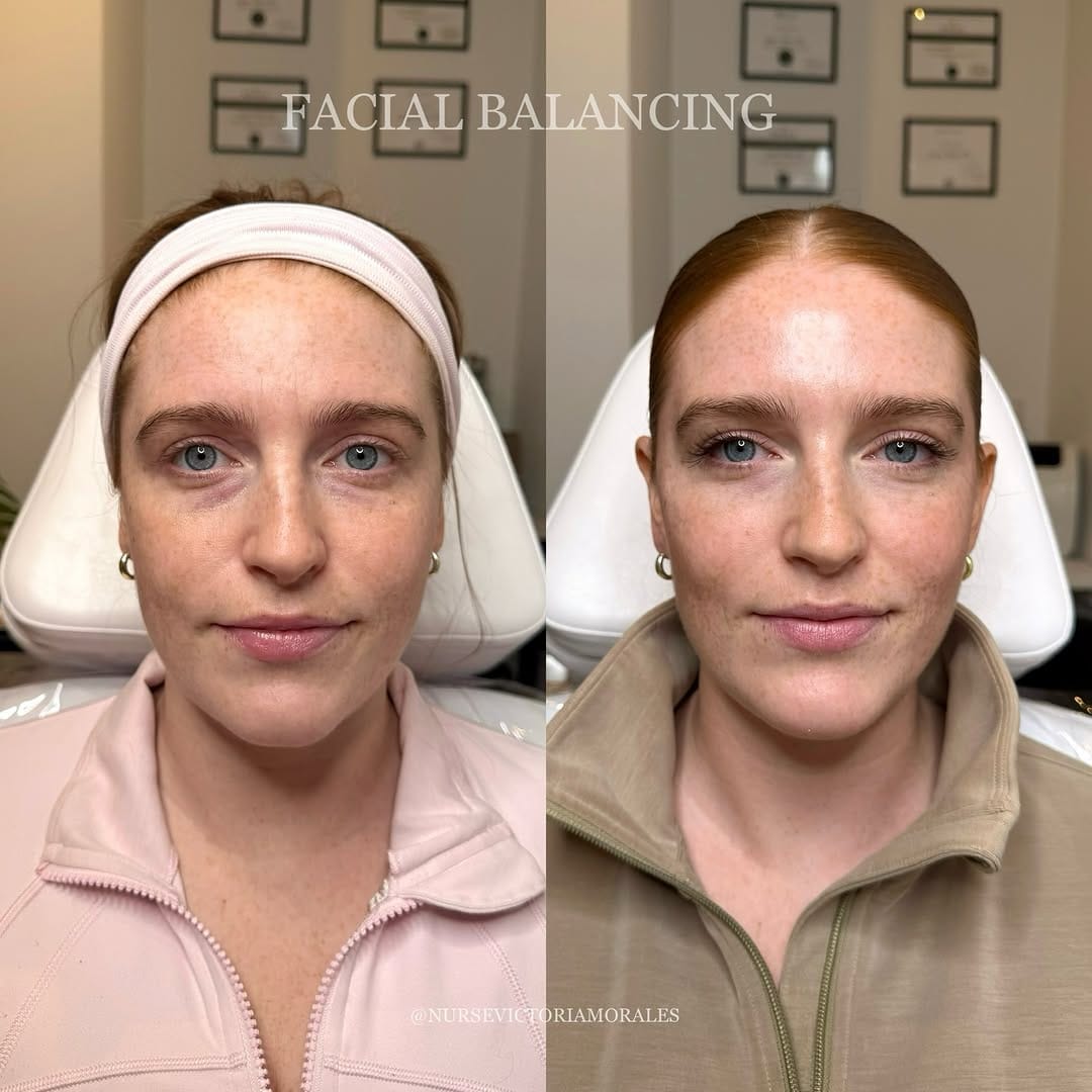 Post 1 by 𝐓𝐎𝐑𝐎𝐍𝐓𝐎 𝐂𝐎𝐒𝐌𝐄𝐓𝐈𝐂 𝐍𝐔𝐑𝐒𝐄💉 on Instagram (carousel)