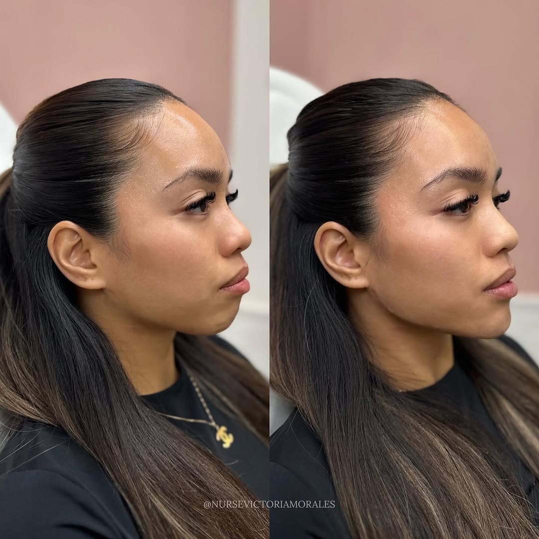 Post 10 by 𝐓𝐎𝐑𝐎𝐍𝐓𝐎 𝐂𝐎𝐒𝐌𝐄𝐓𝐈𝐂 𝐍𝐔𝐑𝐒𝐄💉 on Instagram (image)