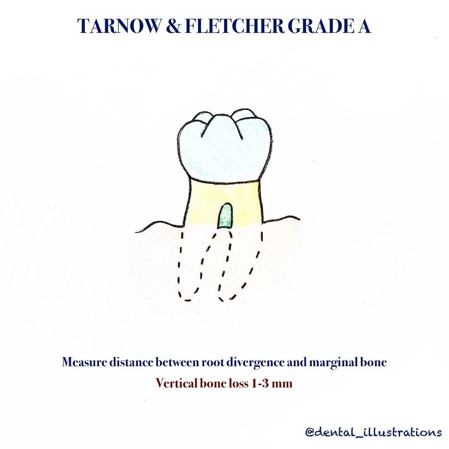 Post 4 by Dental IQ on Instagram (carousel)