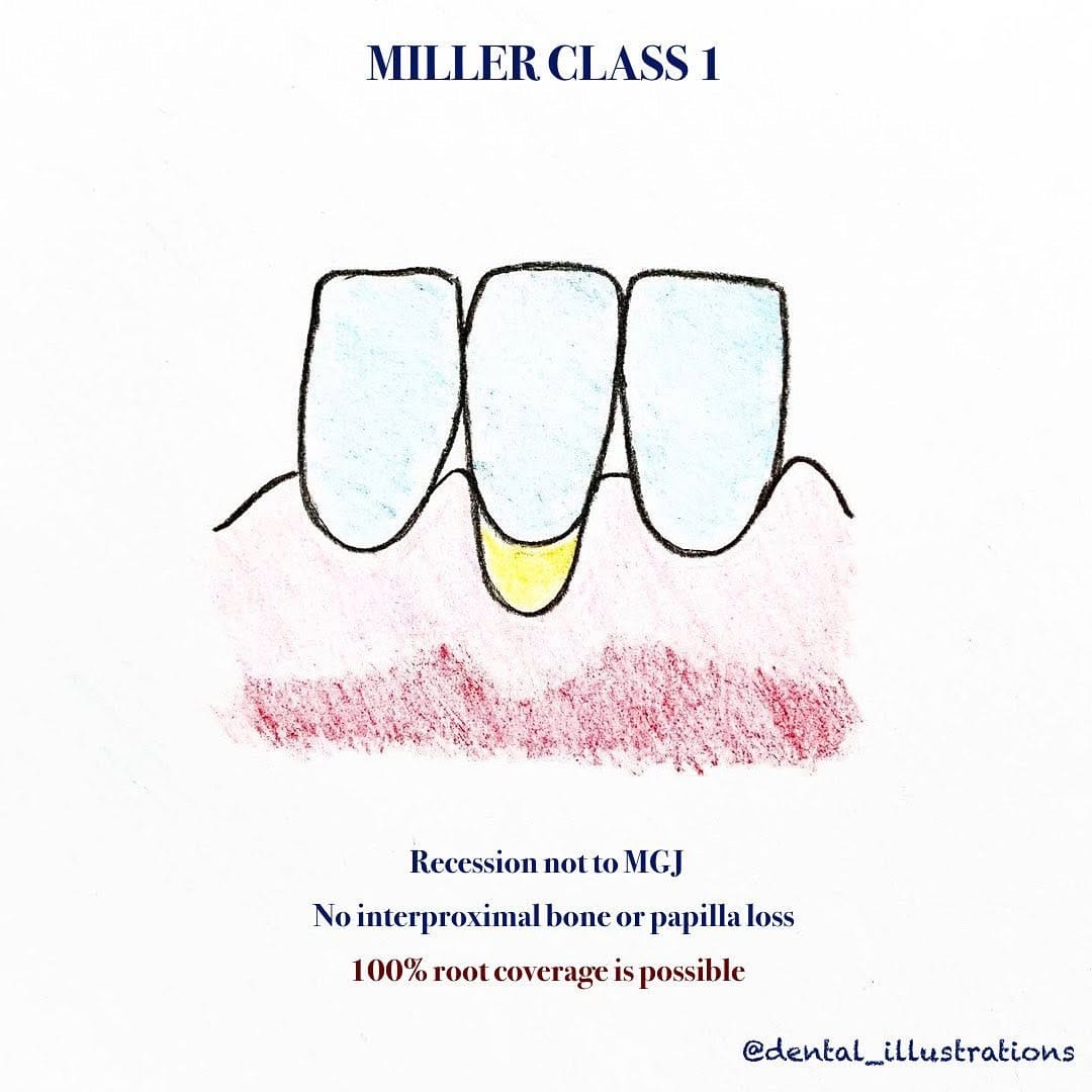Post 2 by Dental IQ on Instagram (carousel)