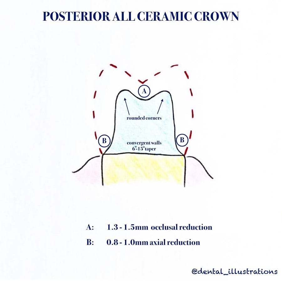 Post 6 by Dental IQ on Instagram (carousel)