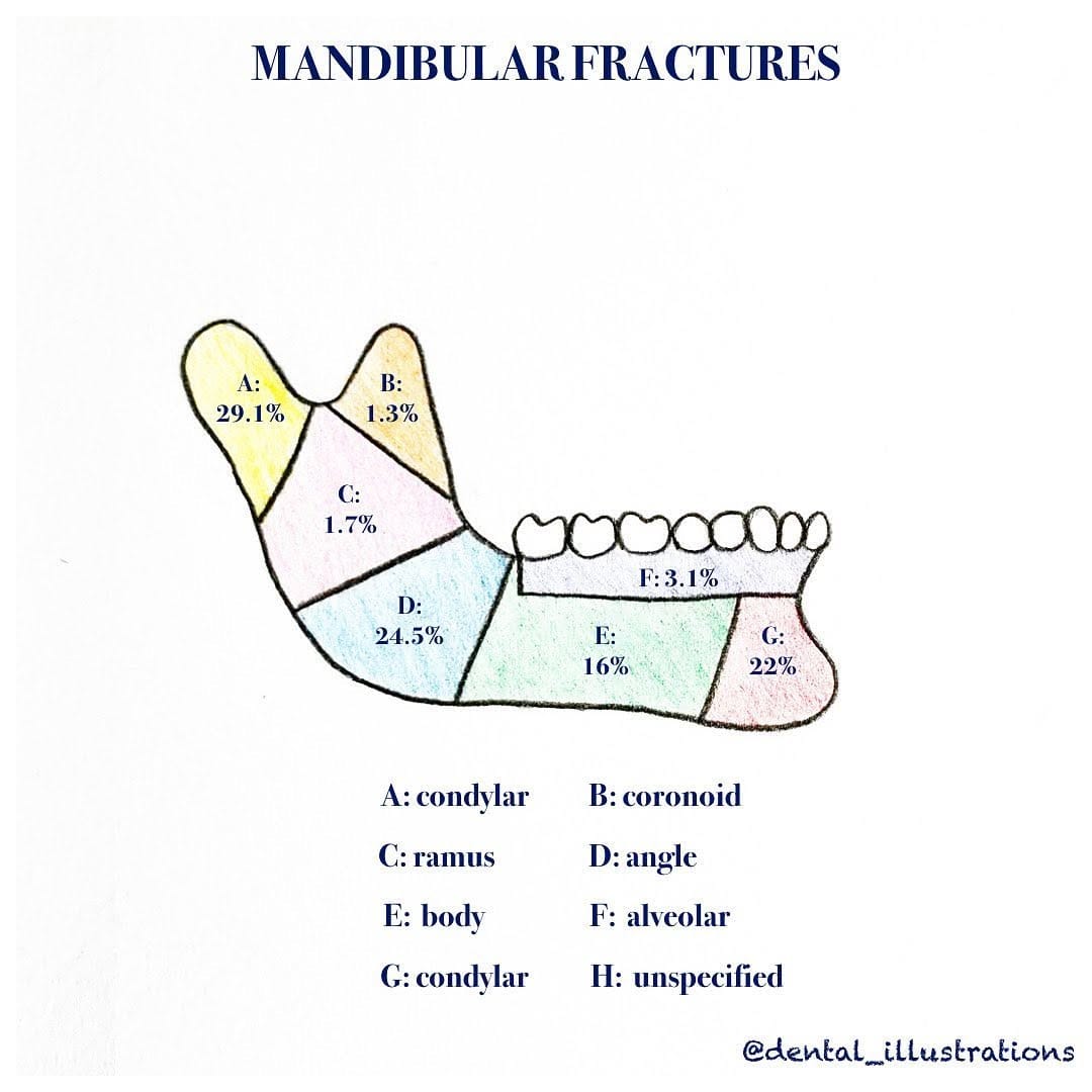 Post 7 by Dental IQ on Instagram (image)