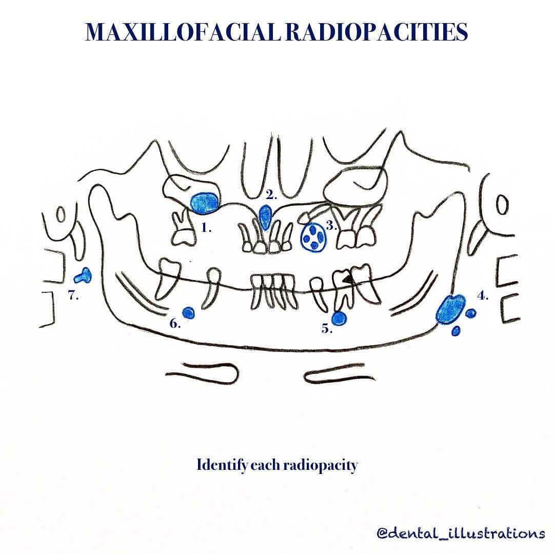 Post 10 by Dental IQ on Instagram (image)