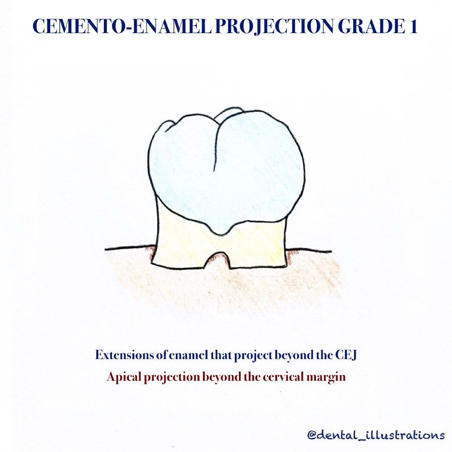 Post 9 by Dental IQ on Instagram (carousel)