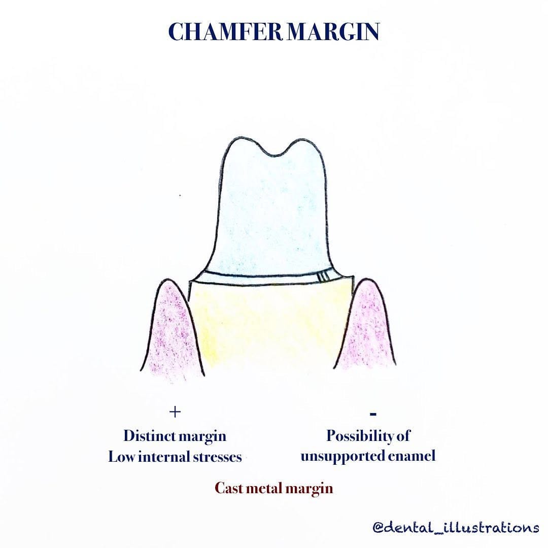 Post 1 by Dental IQ on Instagram (carousel)