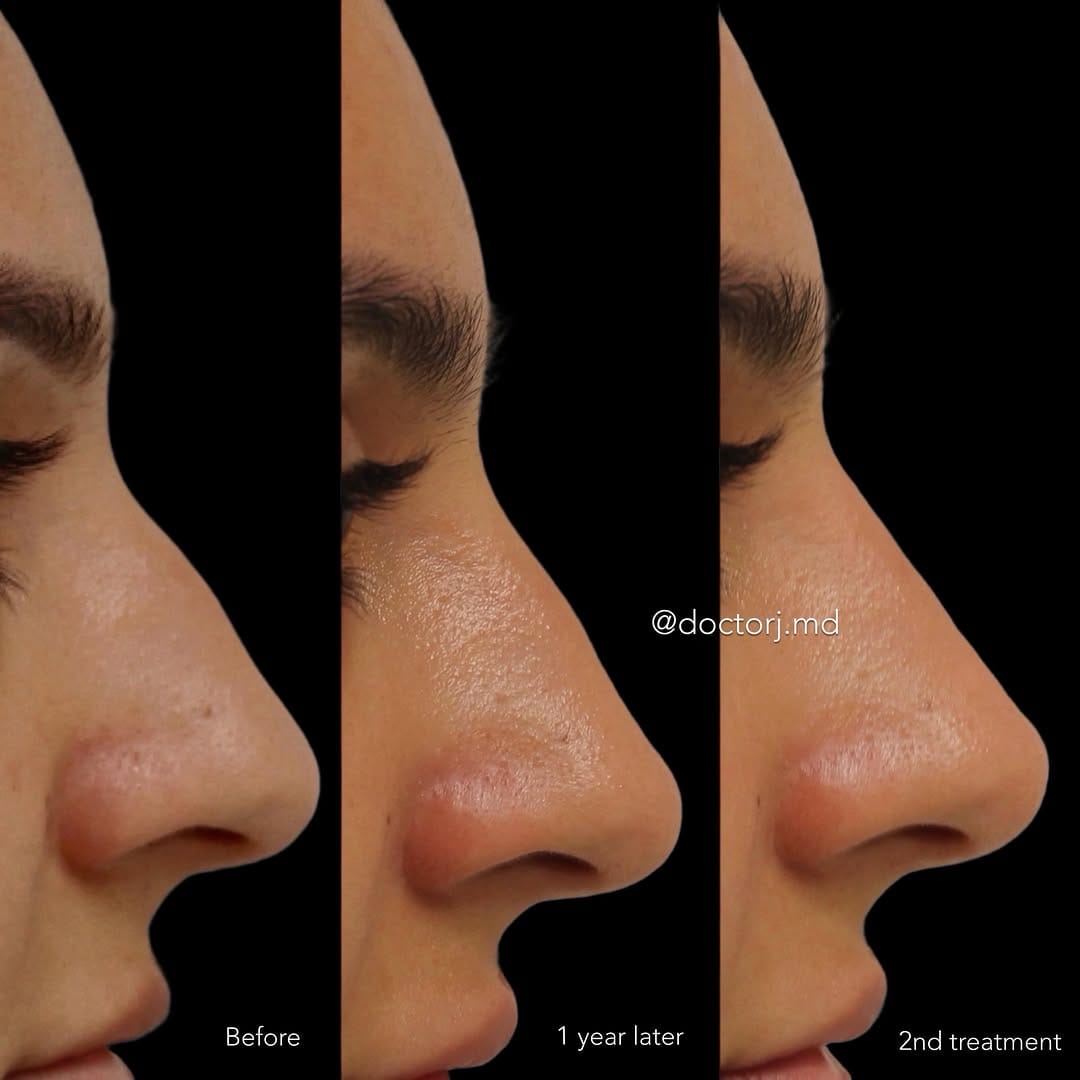Post 4 by Dr A. Jalali M.D. on Instagram (image)