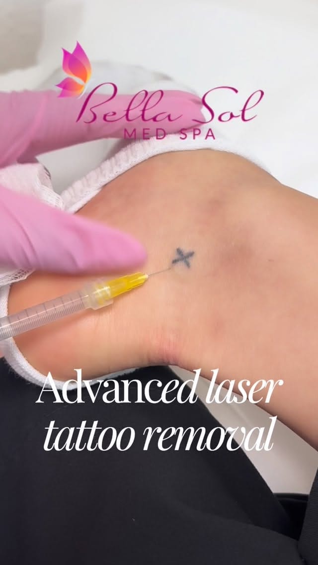 Post 5 by Bella Sol Medical Spa on Instagram (video)
