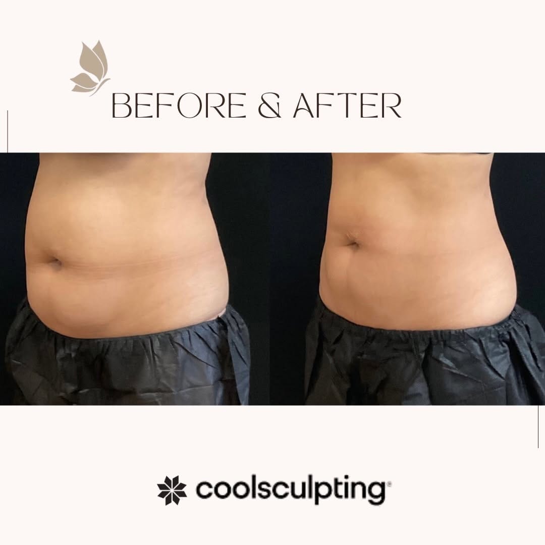 Post 7 by Bella Sol Medical Spa on Instagram (image)