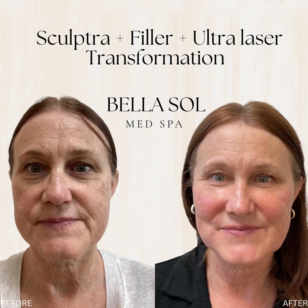 Post 1 by Bella Sol Medical Spa on Instagram (carousel)