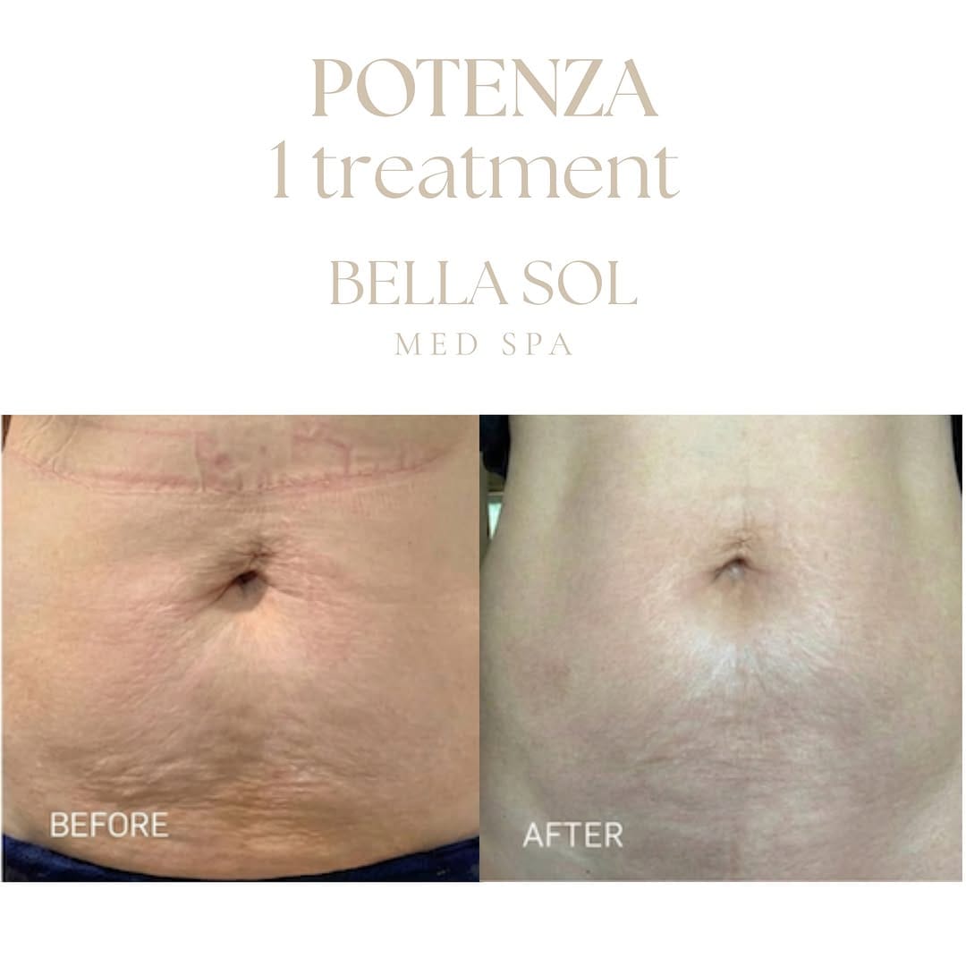 Post 3 by Bella Sol Medical Spa on Instagram (carousel)