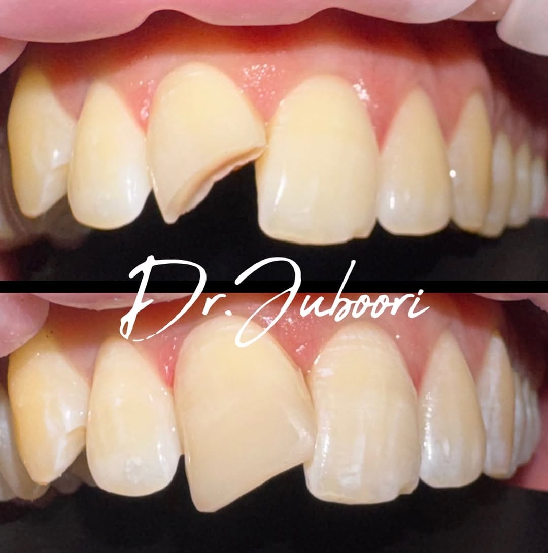 Post 4 by Dr. Al Juboori, BDS, FICOI on Instagram (image)