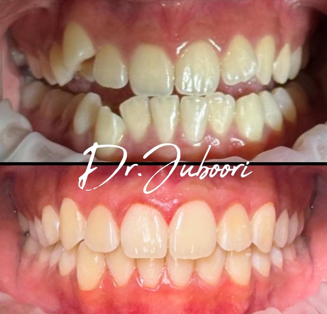 Post 7 by Dr. Al Juboori, BDS, FICOI on Instagram (image)