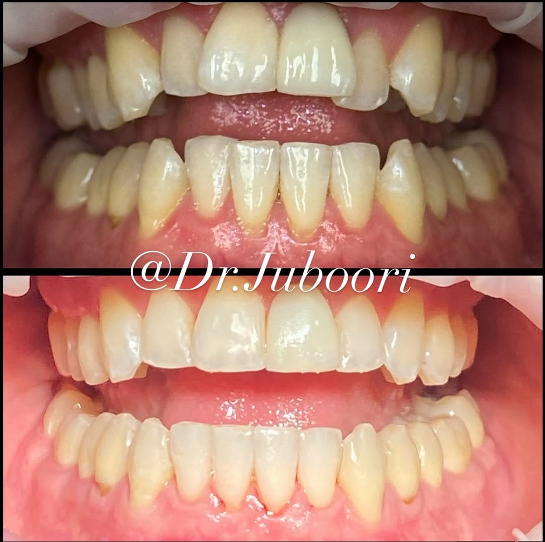 Post 10 by Dr. Al Juboori, BDS, FICOI on Instagram (carousel)