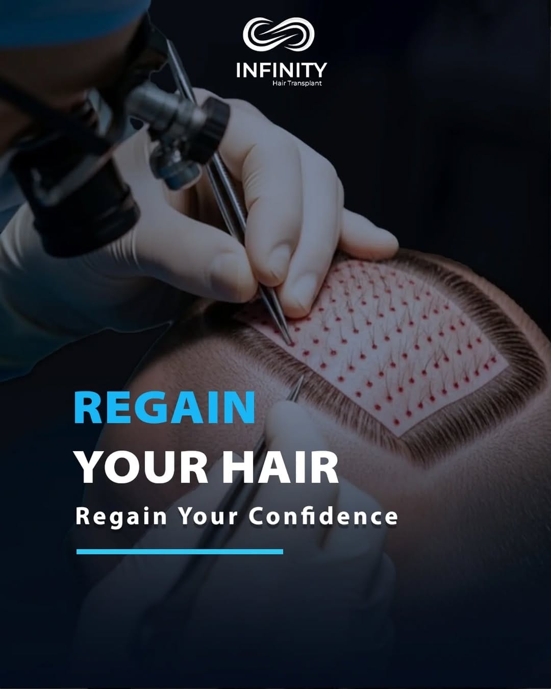 Post 3 by INFINITY hair transplant on Instagram (image)