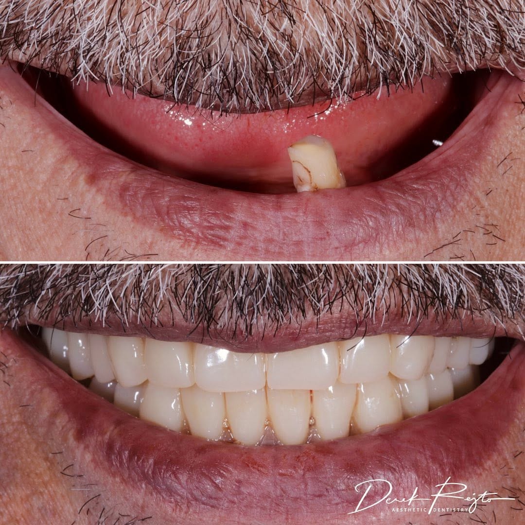 Post 4 by Dr. Derek Rejtő on Instagram (image)