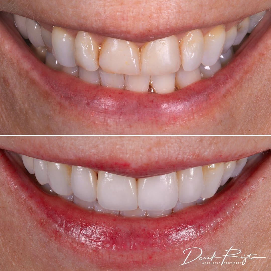 Post 5 by Dr. Derek Rejtő on Instagram (image)