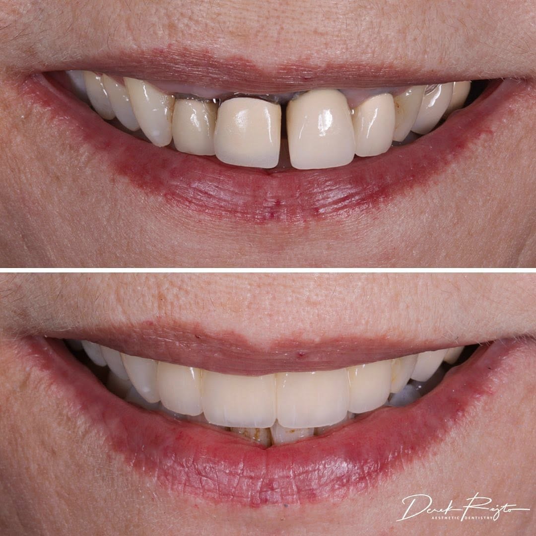 Post 10 by Dr. Derek Rejtő on Instagram (image)