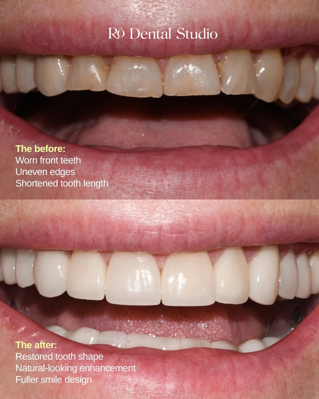 Post 3 by Rō Dental Studio on Instagram (carousel)