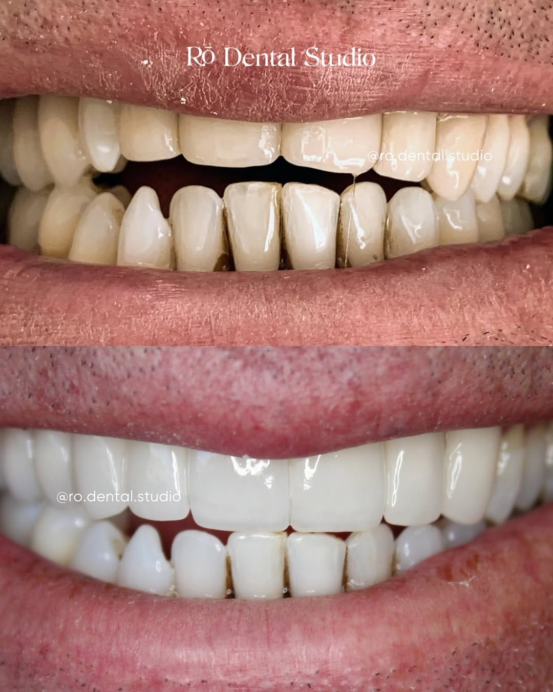Post 9 by Rō Dental Studio on Instagram (image)