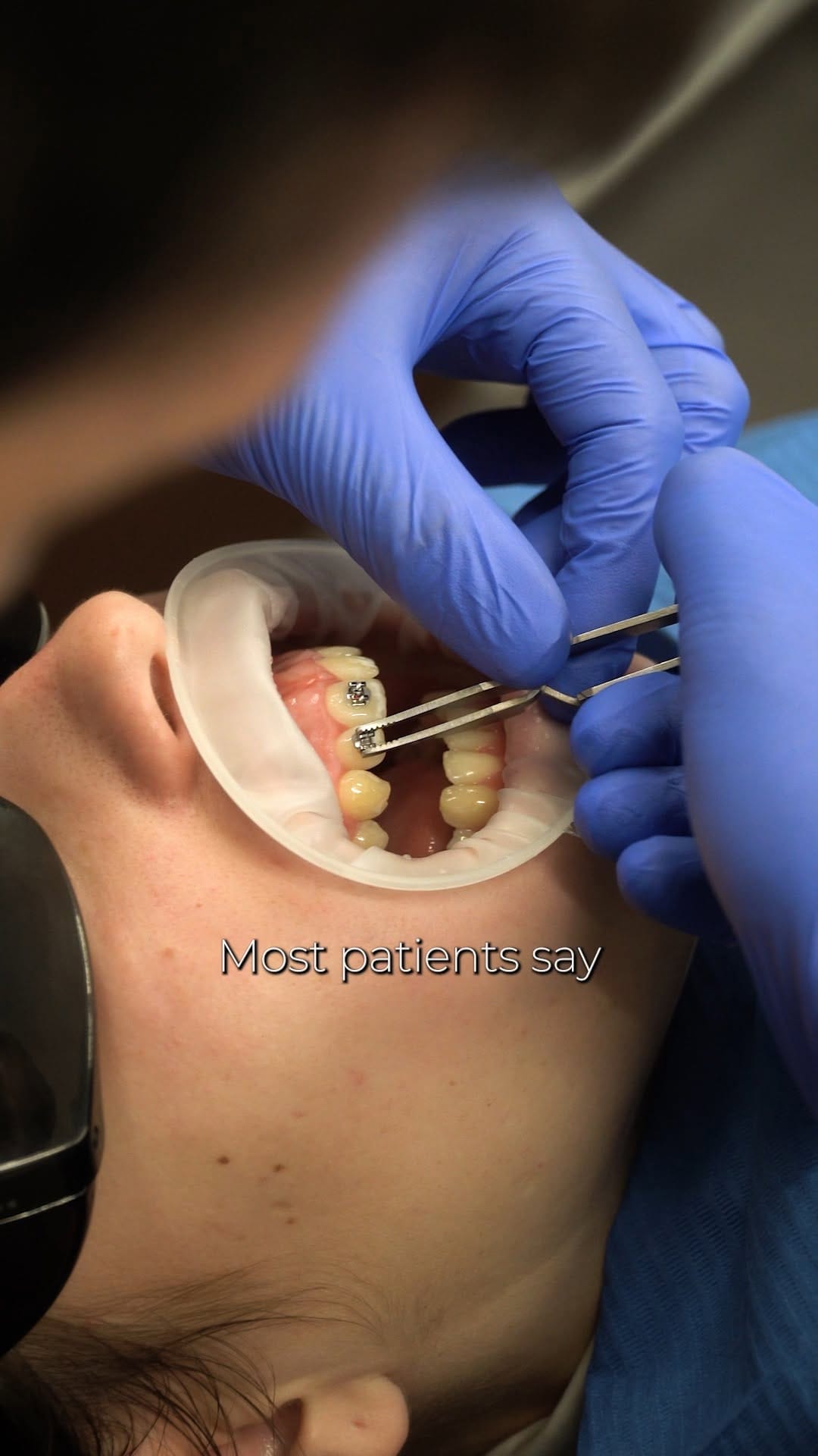 Post 4 by Dental Beauty on Instagram (video)