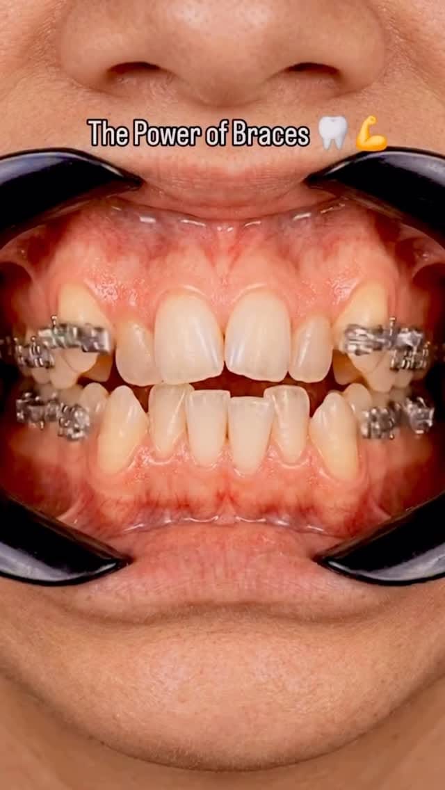 Post 8 by Sunshine Dental Clinic on Instagram (video)