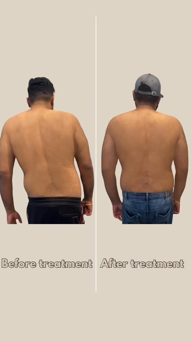 Post 10 by Ignite Health on Instagram (video)