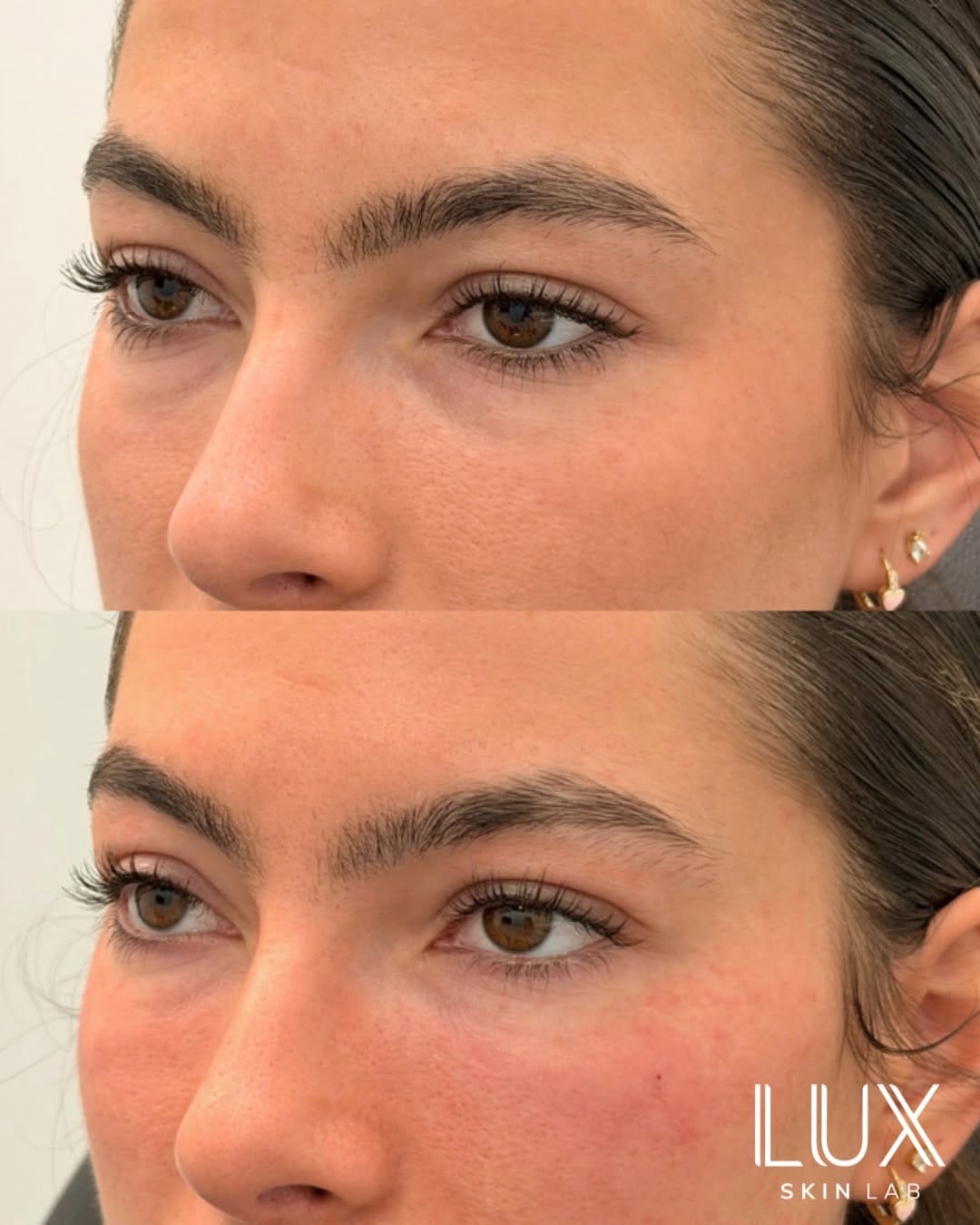 Post 9 by Lux Skin Lab on Instagram (carousel)
