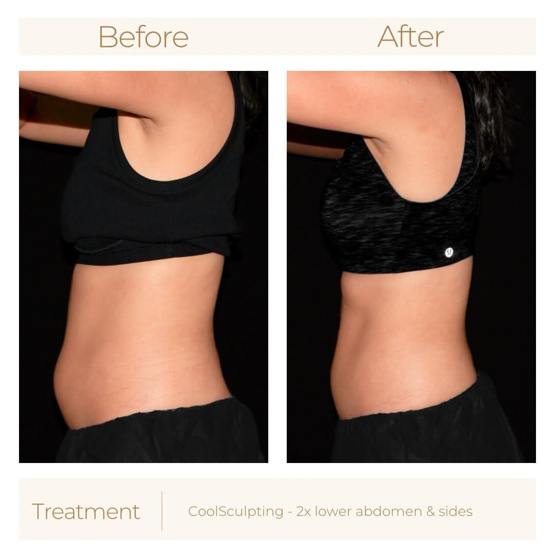 Post 6 by Medical Rejuvenation Centre on Instagram (carousel)