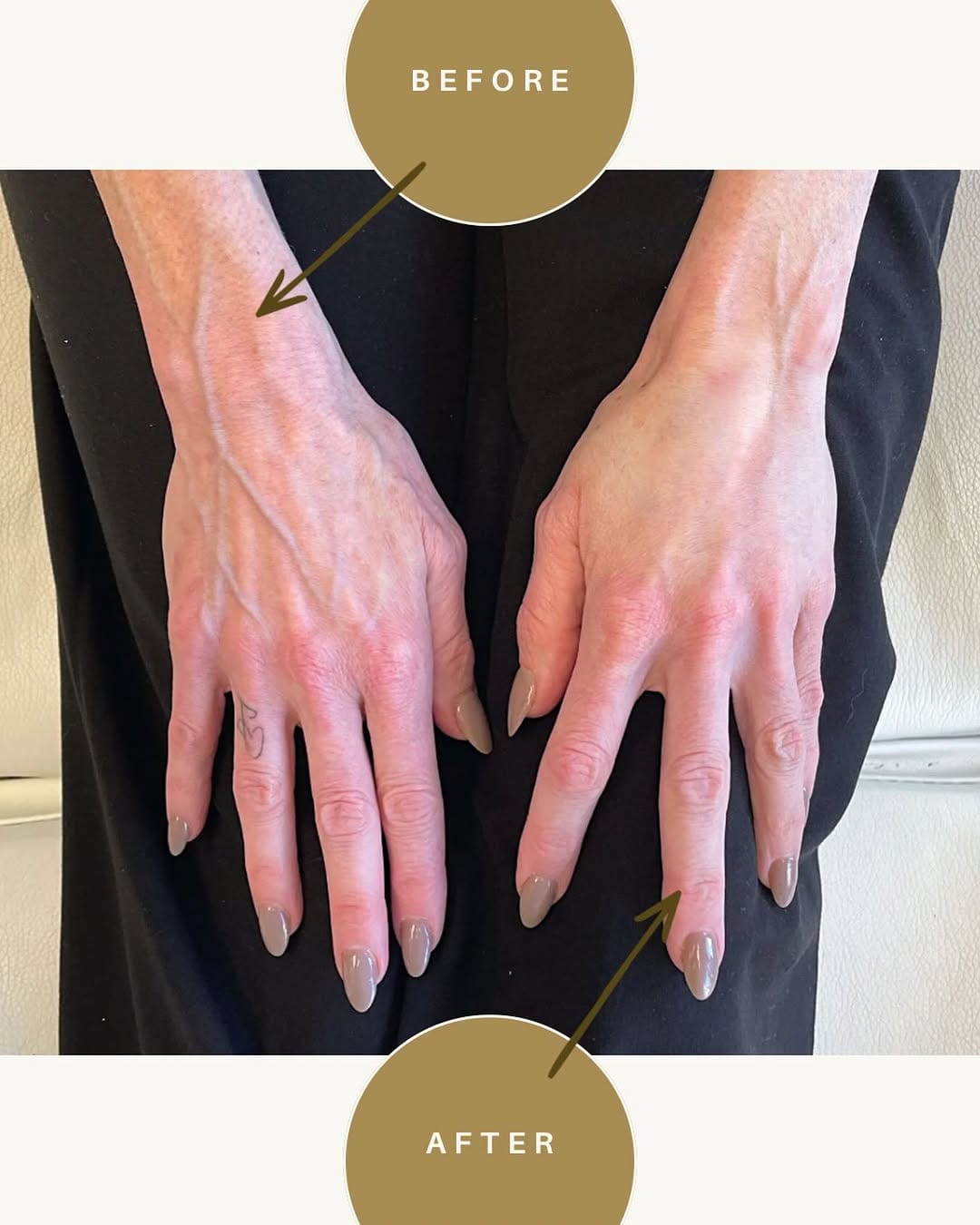 Post 3 by Medical Rejuvenation Centre on Instagram (image)